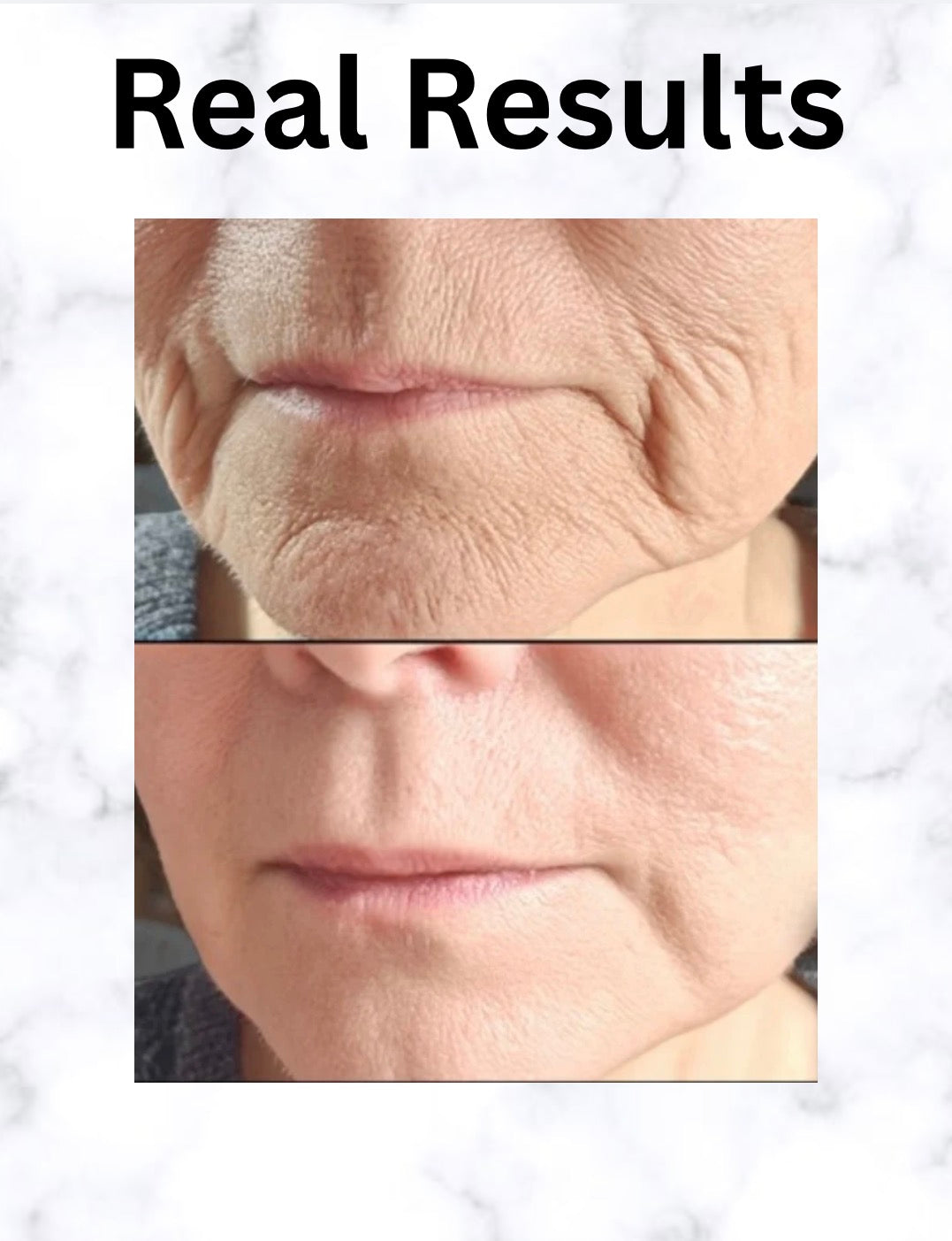 “Forever Young” Anti-aging Moisturizer
